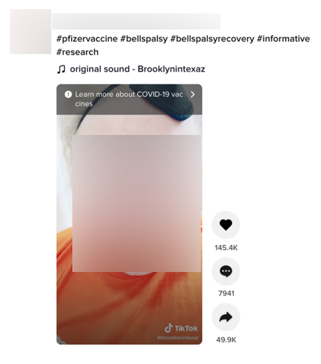 Bell's Palsy
